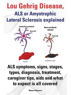 Lou Gehrig Disease, ALS or Amyotrophic Lateral Sclerosis Explained. ALS Symptoms, Signs, Stages, Types, Diagnosis, Treatment, Caregiver Tips, AIDS and - Boganto