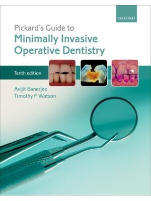 Pickard's Guide to Minimally Invasive Operative Dentistry - Boganto