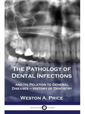 The Pathology of Dental Infections: and Its Relation to General Diseases - History of Dentistry - Boganto