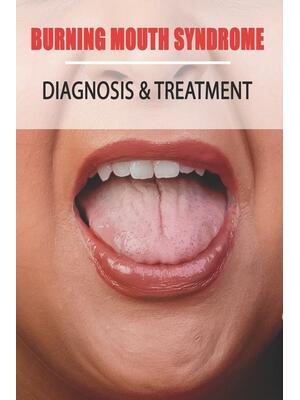 Burning Mouth Syndrome : Diagnosis & Treatment: Burning Mouth Syndrome Guide - Boganto